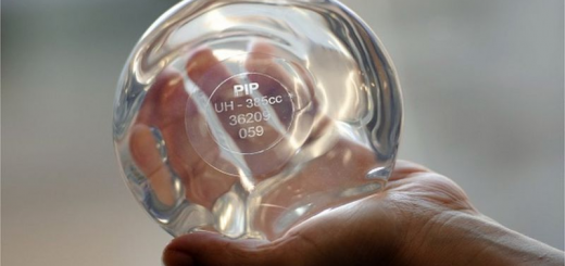 У французькому суді тисячі жінок виграли компенсацію через неякісні грудні імпланти